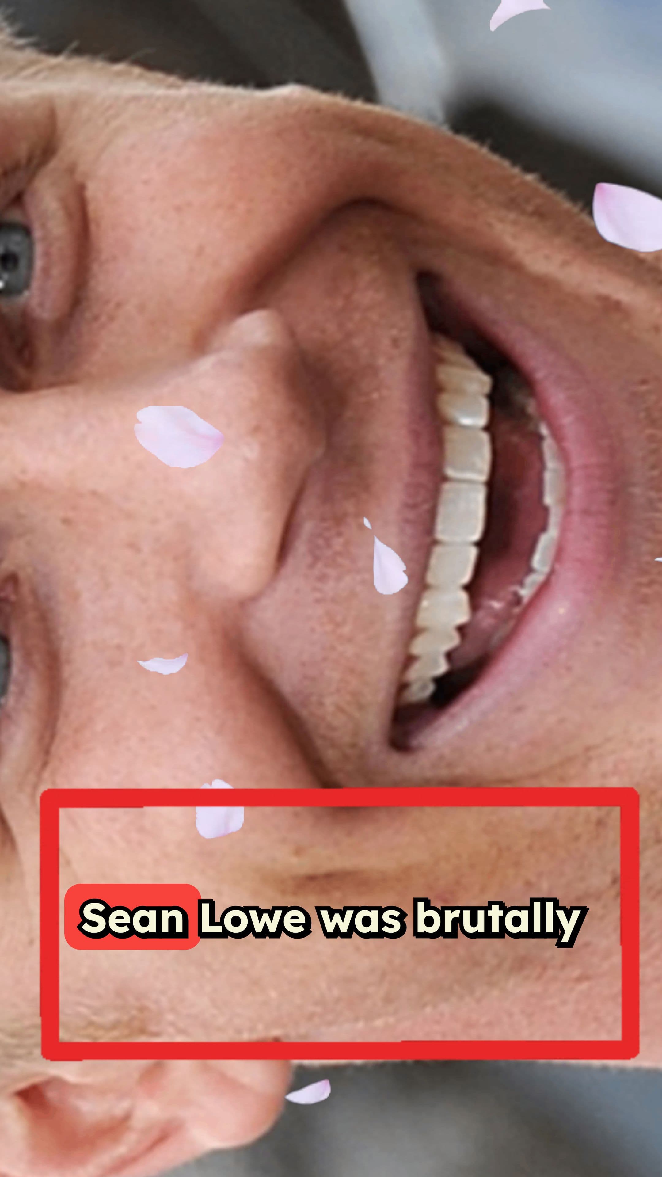 Sean Lowe Attacked Twice by Rescue Dog