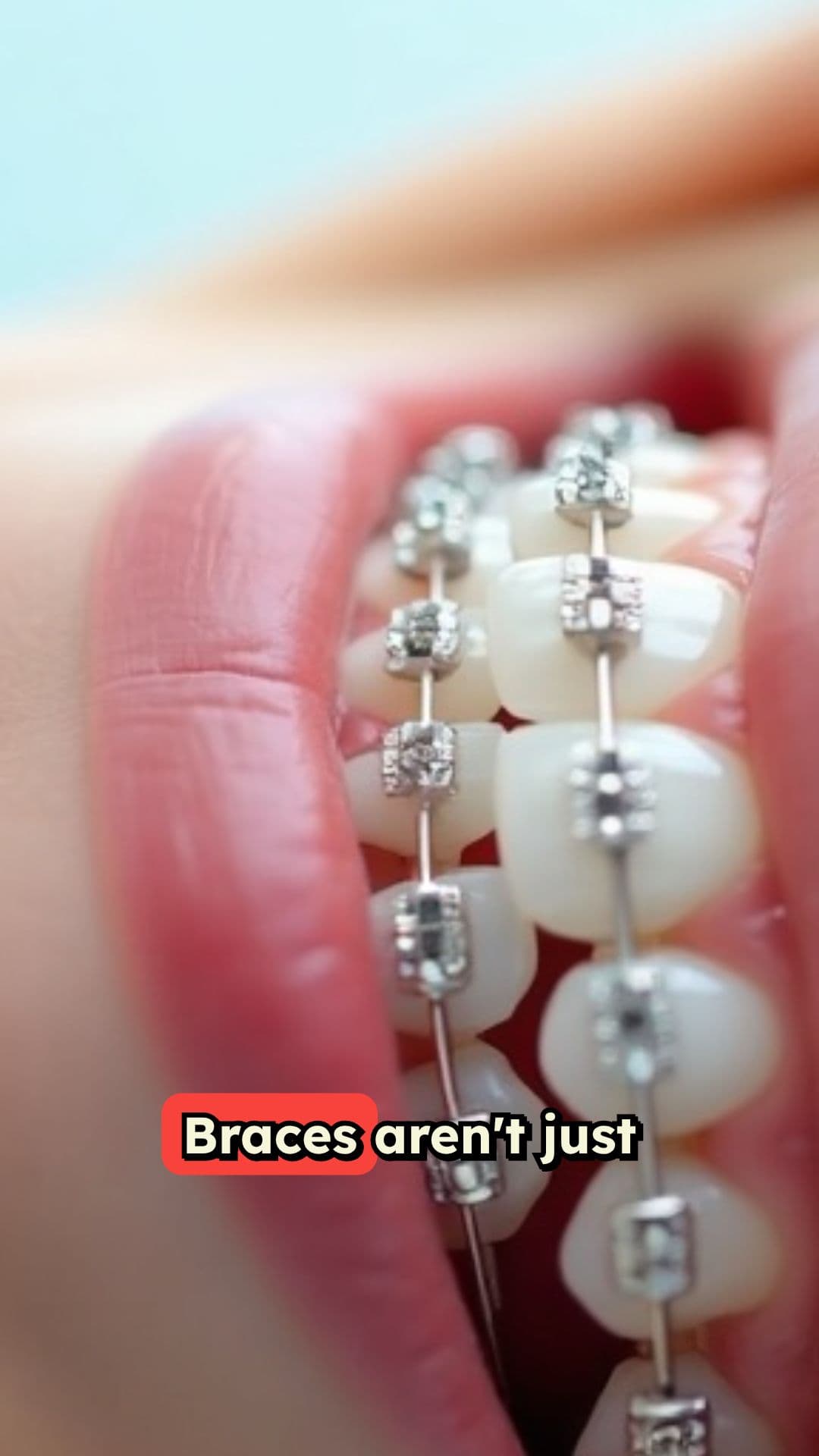 Commit to Your Retainer for Lasting Results