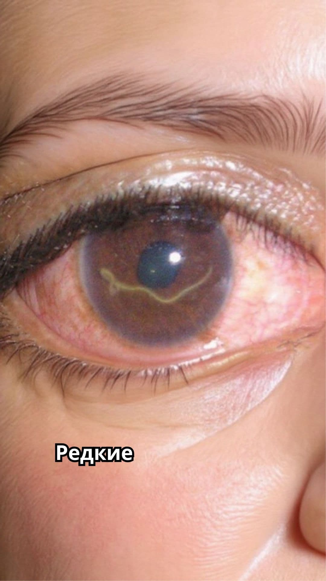 Редкие и шокирующие фотографии