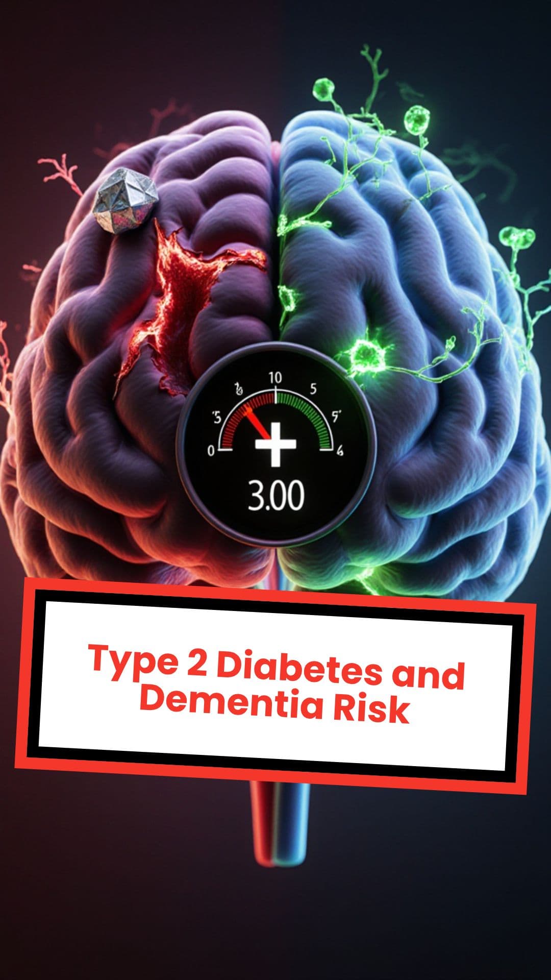 Type 2 Diabetes and Dementia Risk