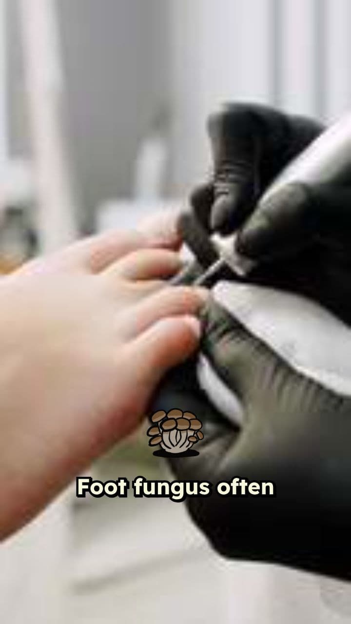 Daily Care Tips for Foot Fungus