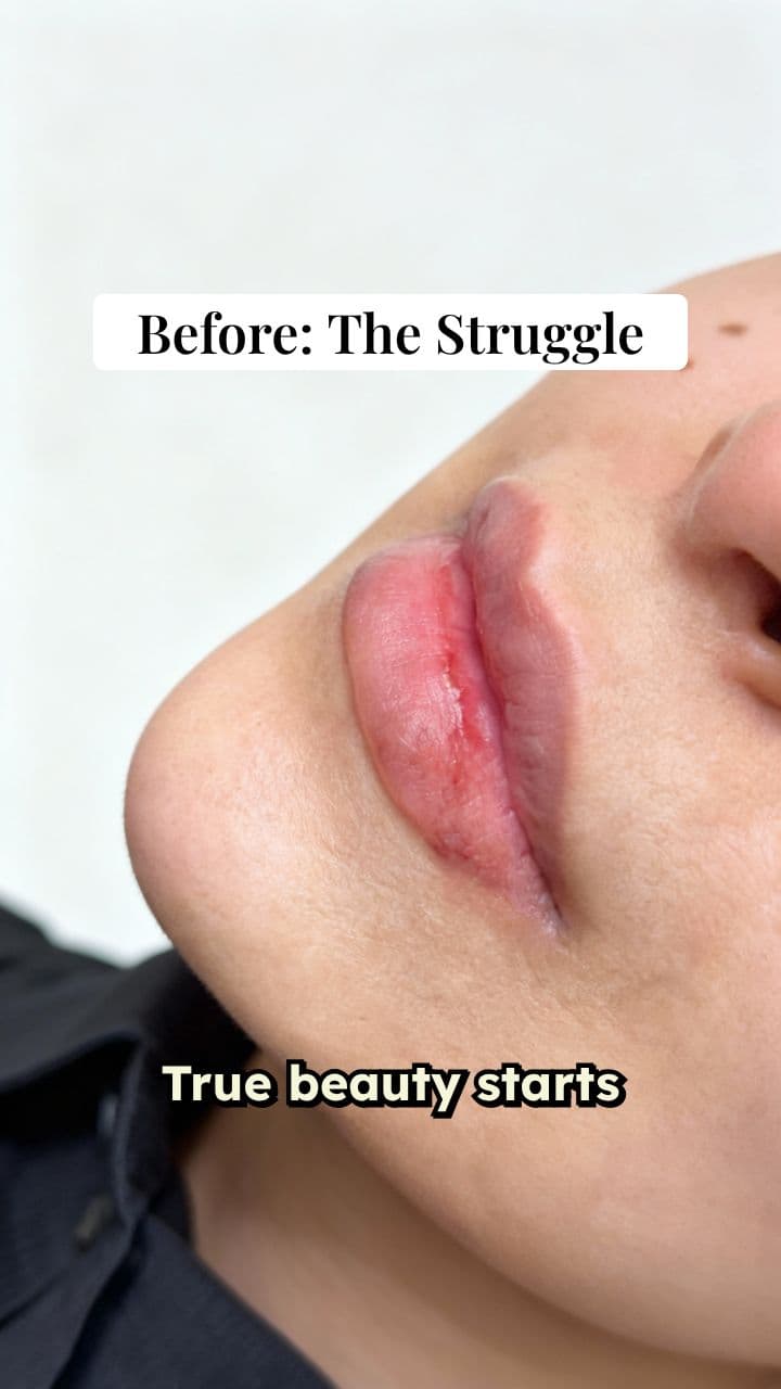 Natural Lip Glow Up Transformation