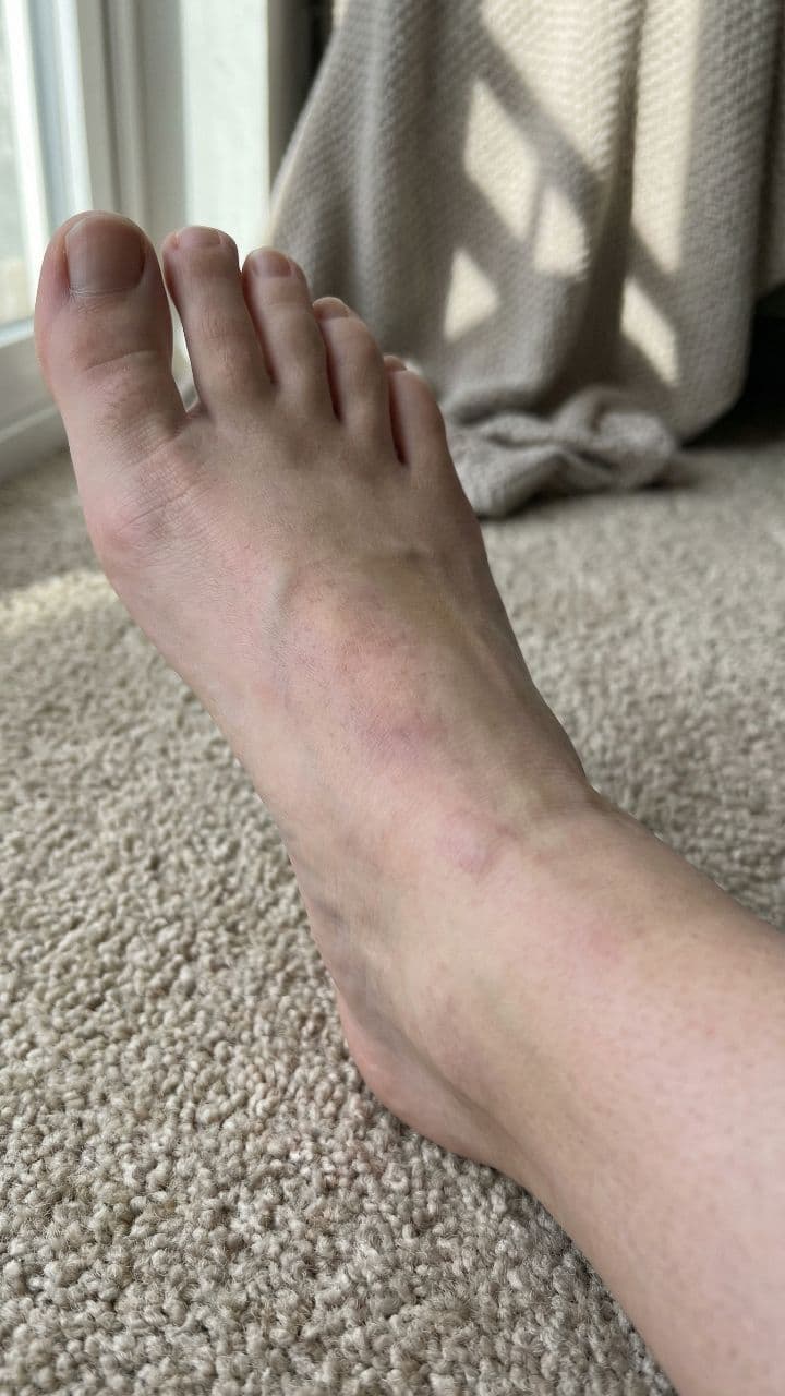 The Language of Foot Color Warnings