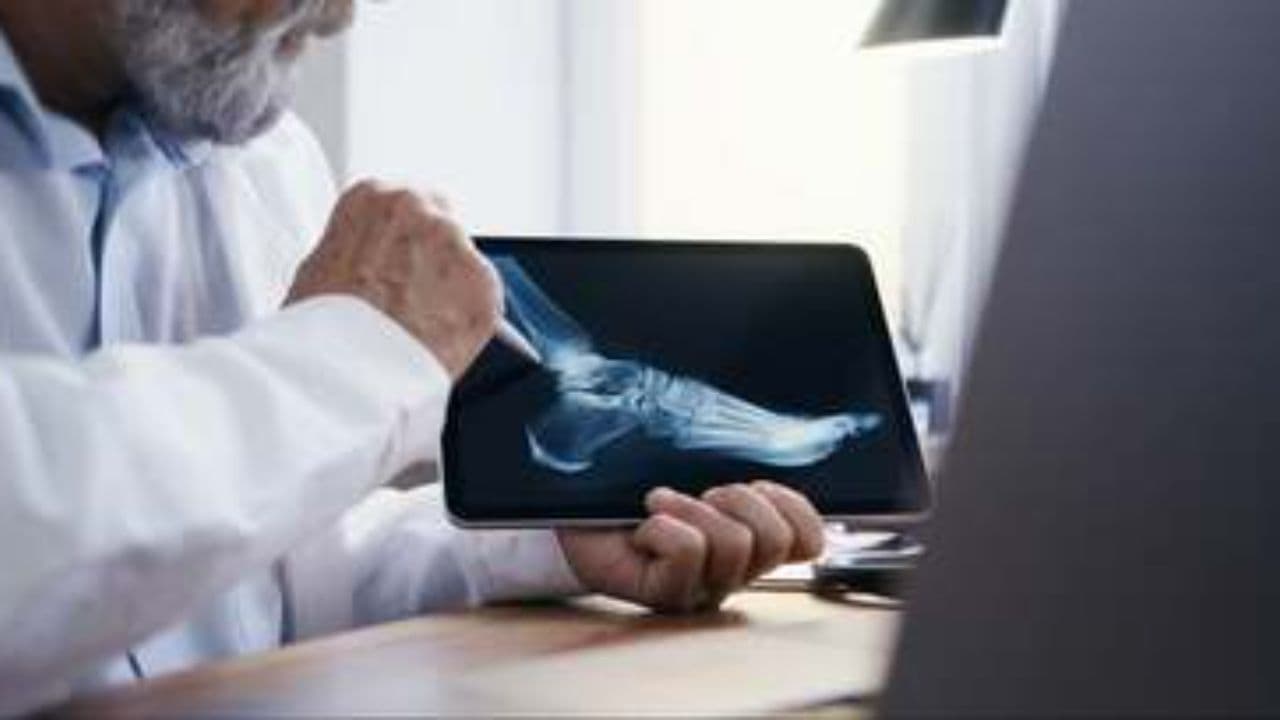 Keto Diet Risks for Seniors