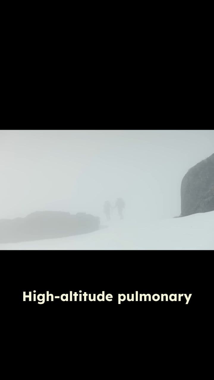 How Altitude Sickness Kills You