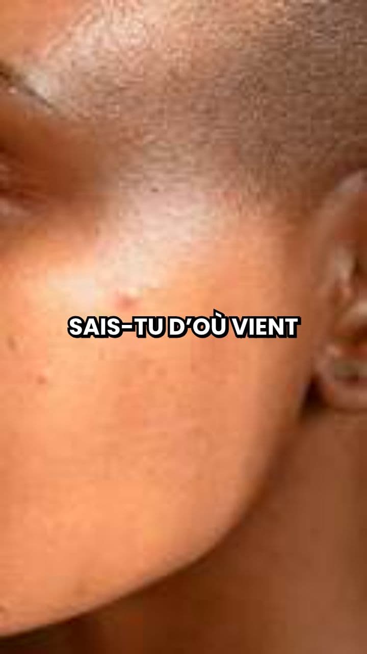 9. Avoir la chair de poule