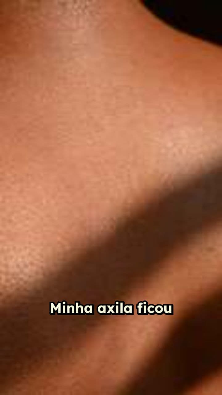 Axilas Claras com Depilação em Casa