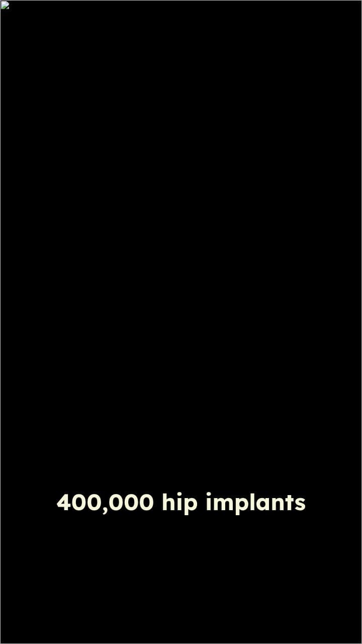 Hip Implant Recall Due to Manufacturing Error