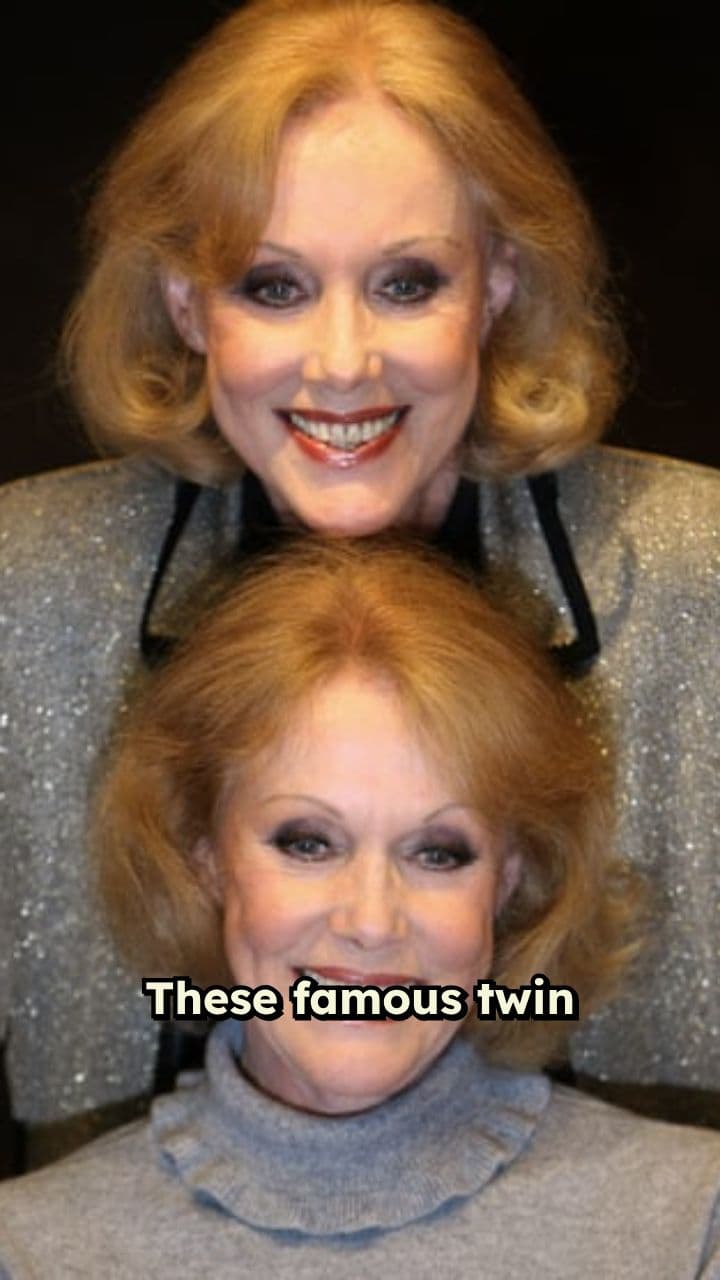 Inseparable Sisters Choose Joint Departure