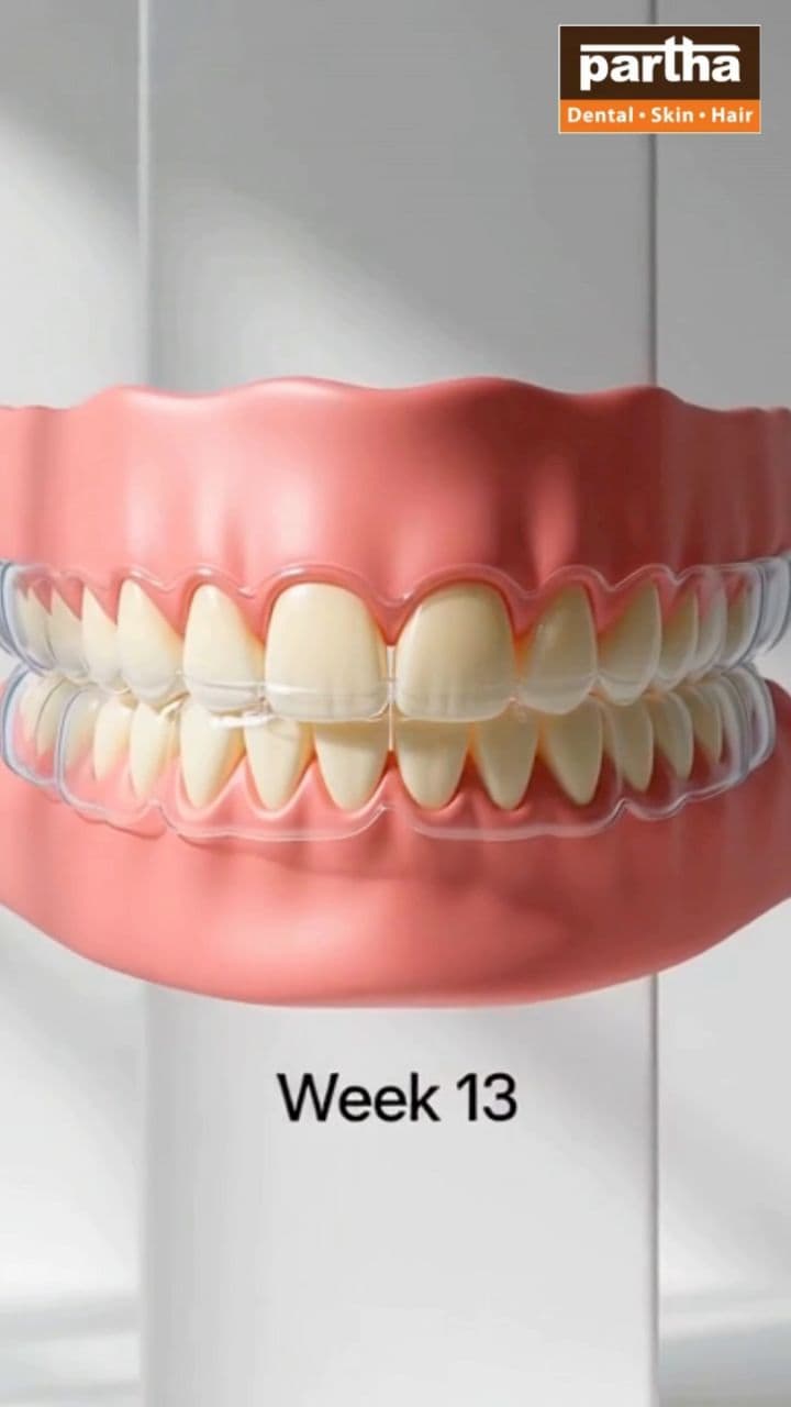 Transform Your Smile with Invisalign