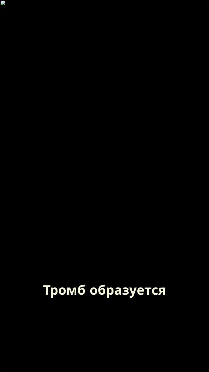 Борщ и тромбы: странные связи