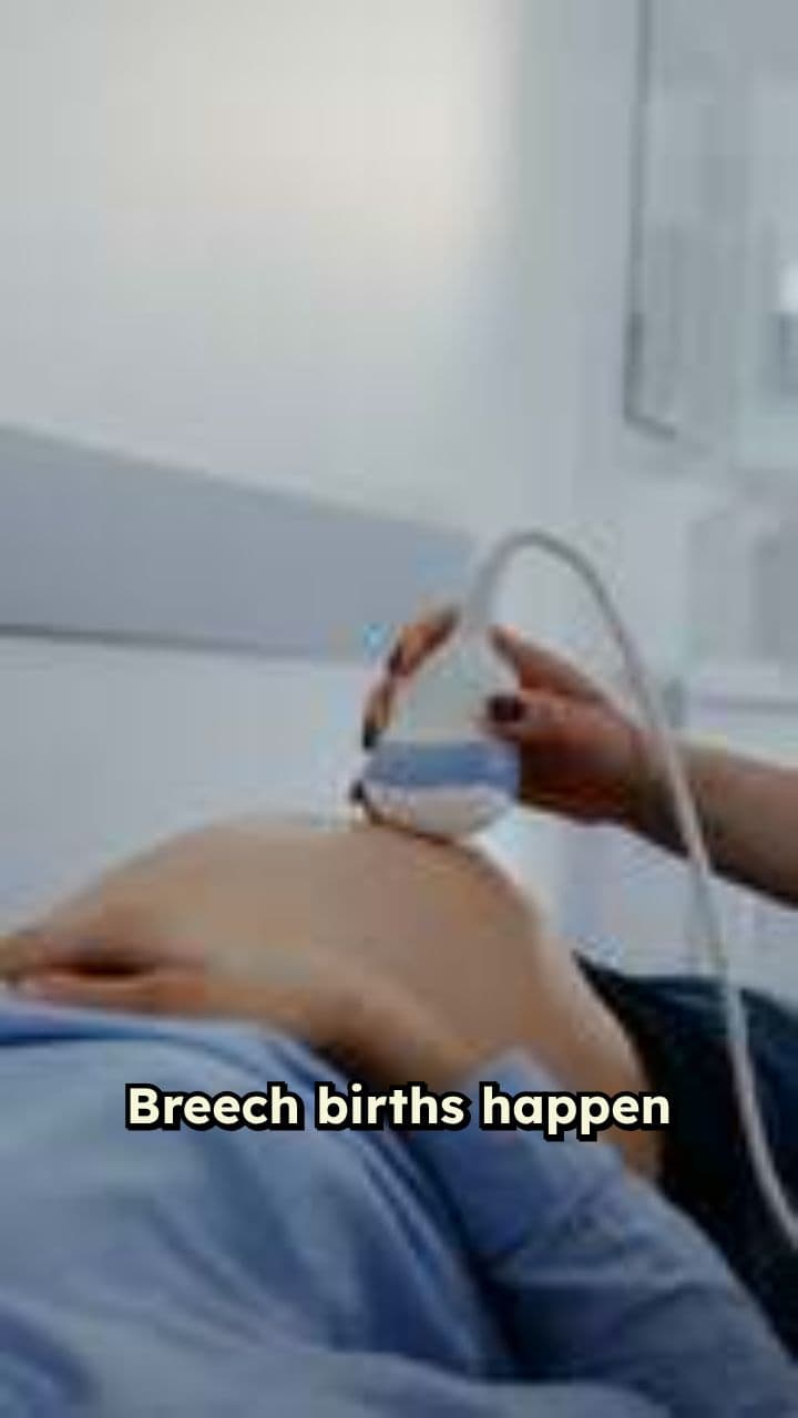 Understanding Breech Births