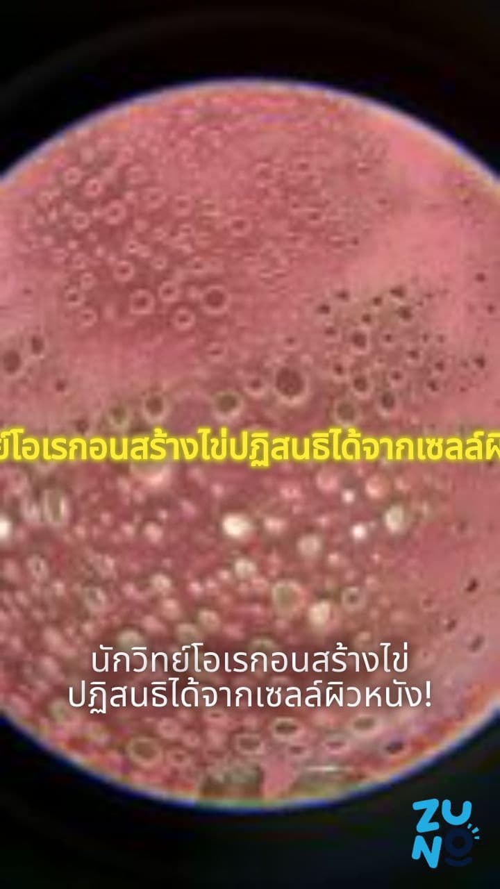 นักวิทยาศาสตร์โอเรกอนสร้างไข่ที่สามารถปฏิสนธิได้จากเซลล์ผิวหนัง แต่เผชิญกับความผิดปกติทางโครโมโซม