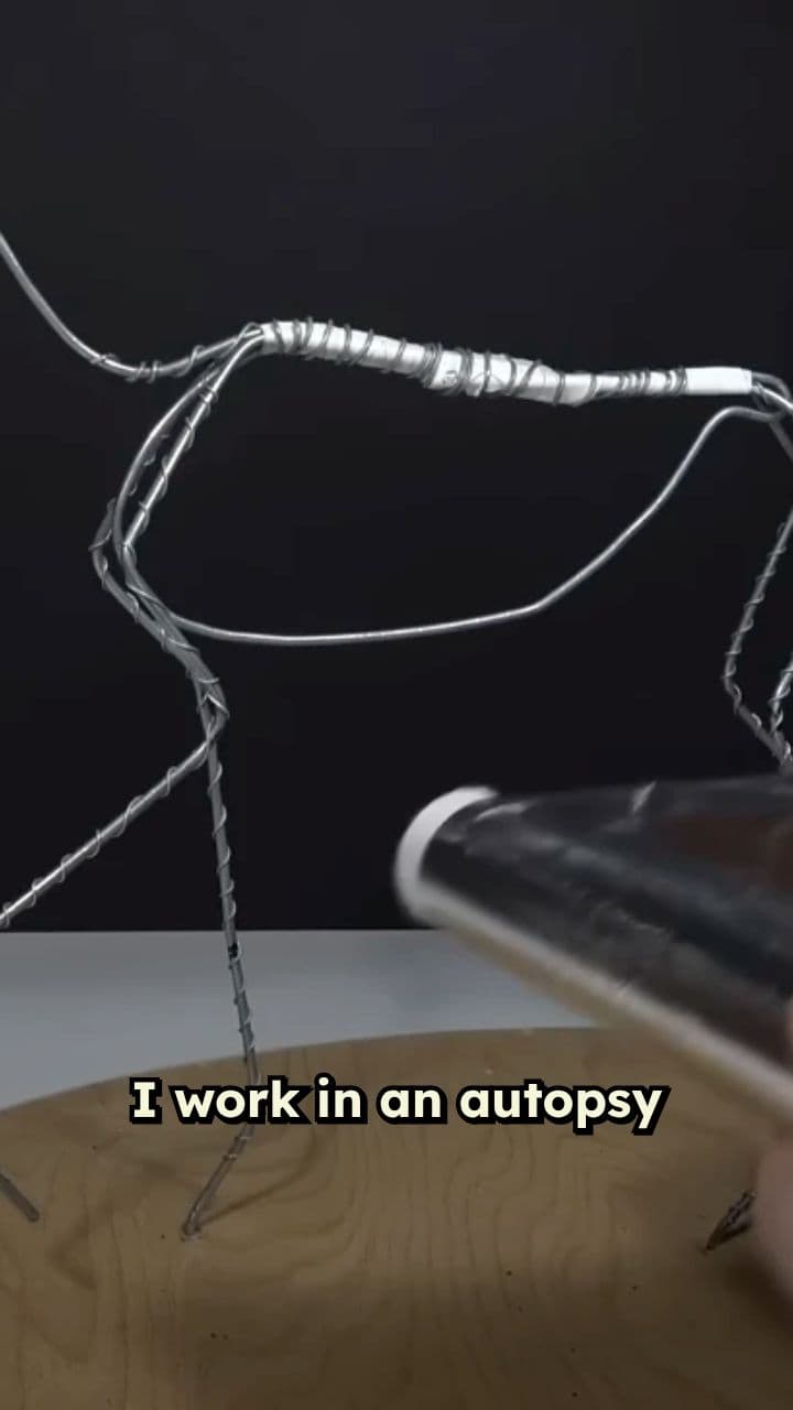 Missing Body Mystery Unraveled