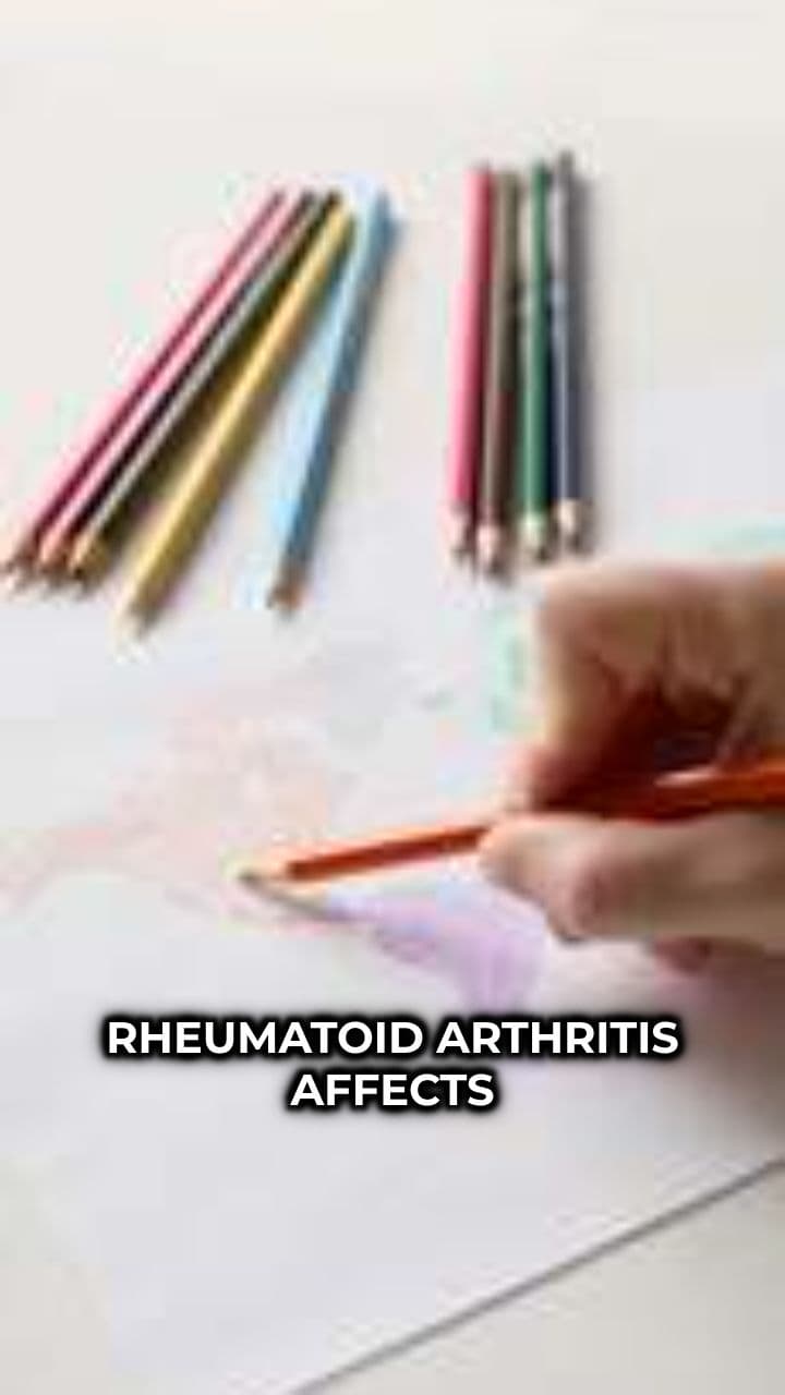 Rheumatoid Arthritis: What Medical Students Miss