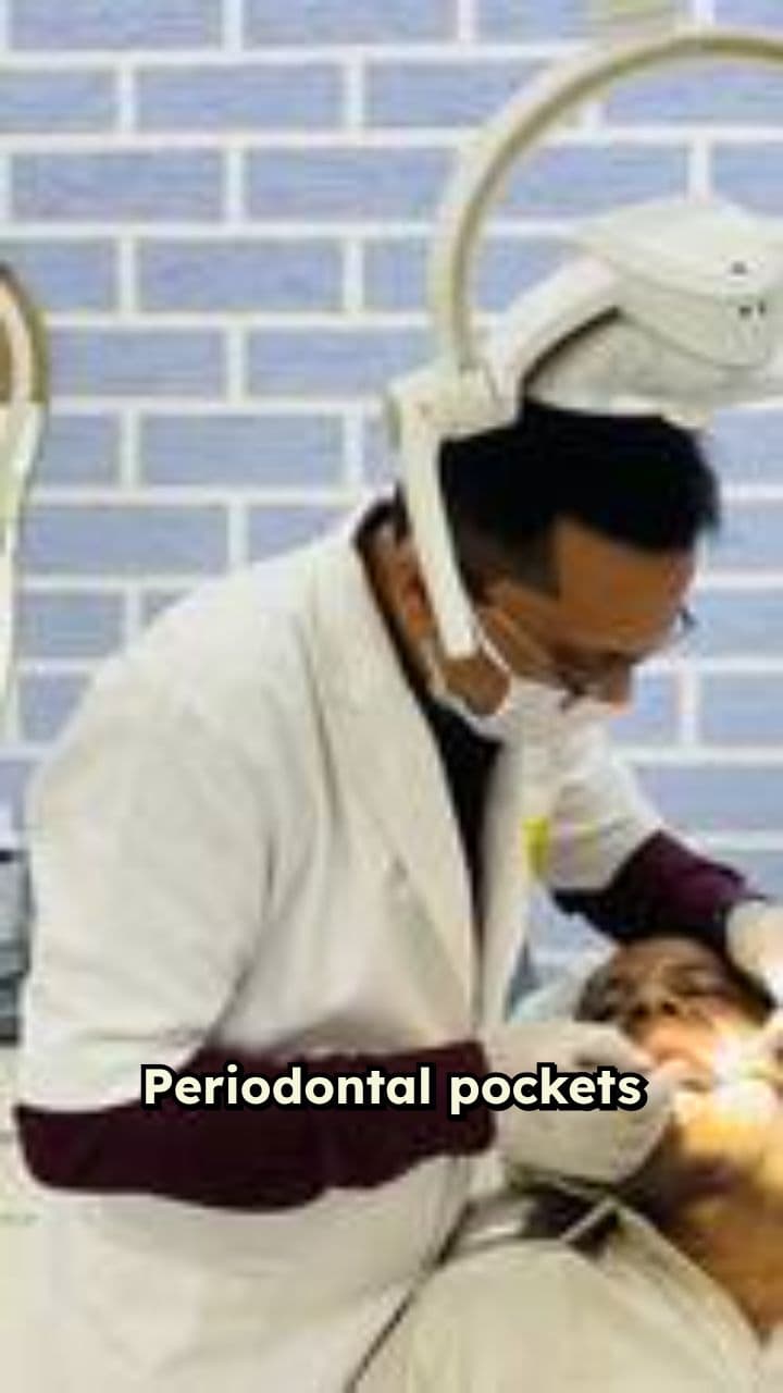 Periodontal Pockets and Hidden Heart Risk