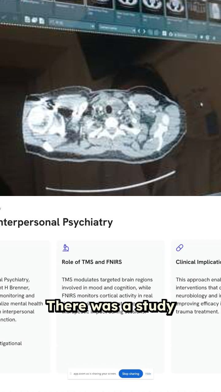TMS vs. Antidepressants: The Results Are In