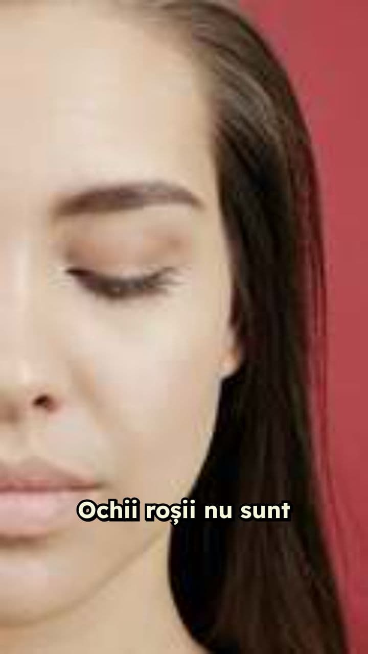 Îngrijirea ochilor roșii