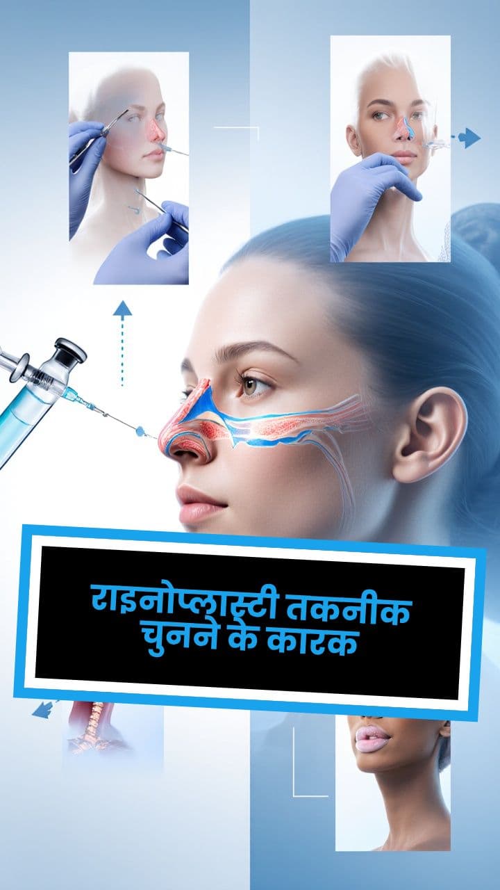 राइनोप्लास्टी तकनीक चुनने के कारक