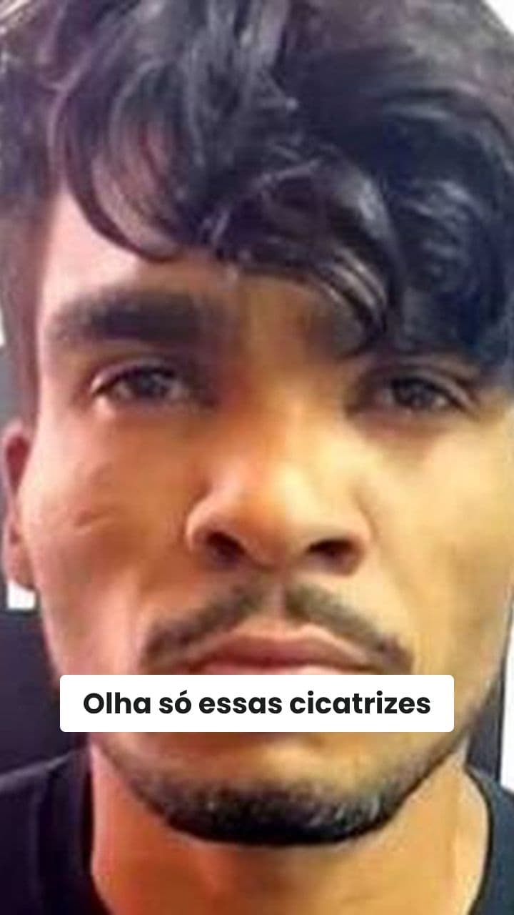 Cicatrizes de Resistência