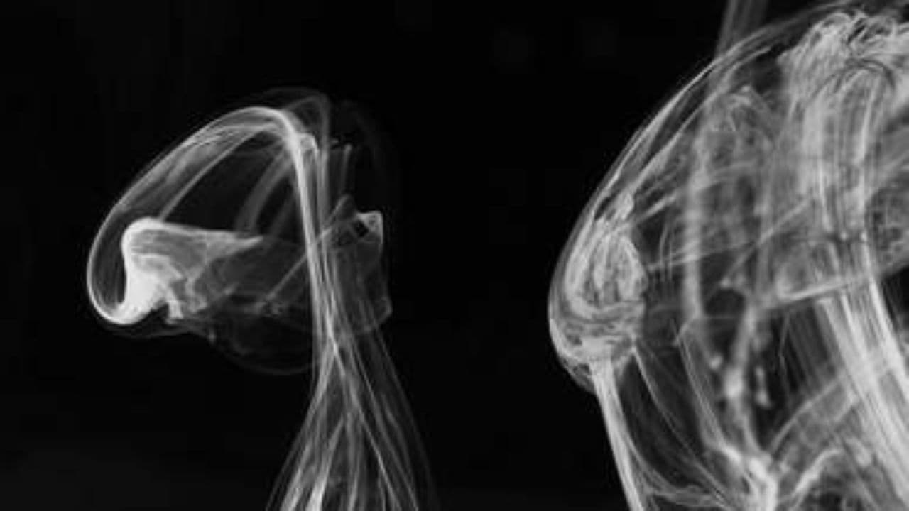 Euphoric Progressive House Anthem