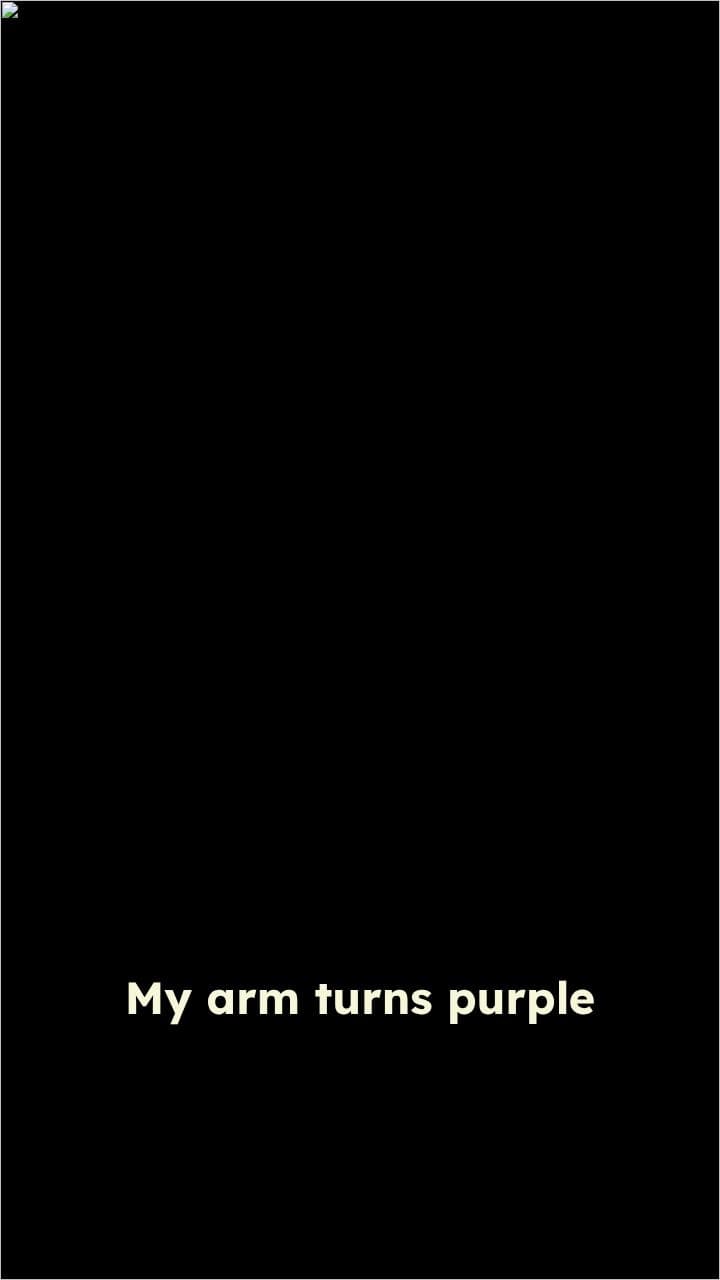 Purple Arm Syndrome: Seeking Answers