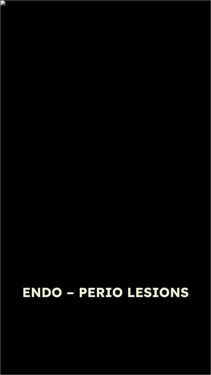 Endo-Perio Lesions Overview