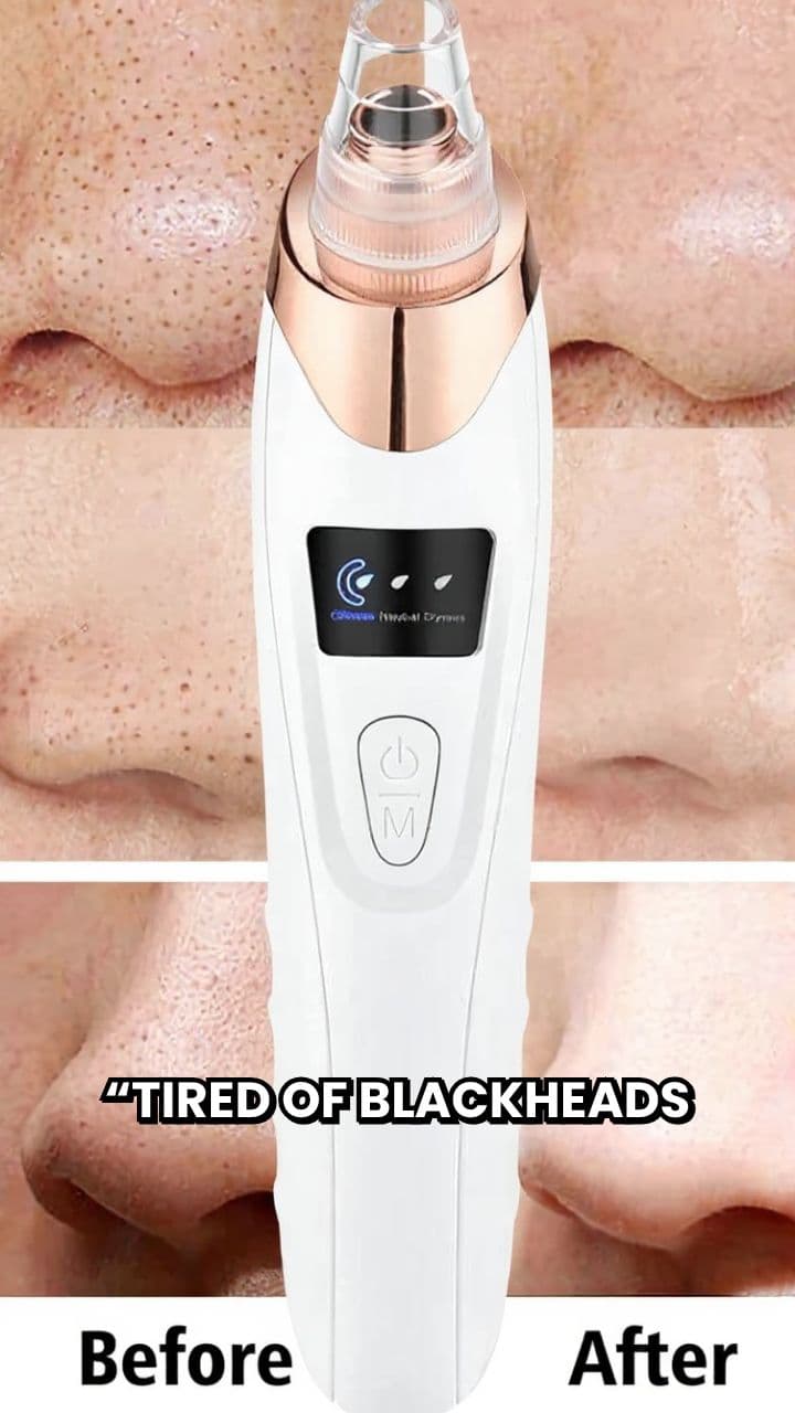 Clear Skin with Blackhead Vacuum Remover