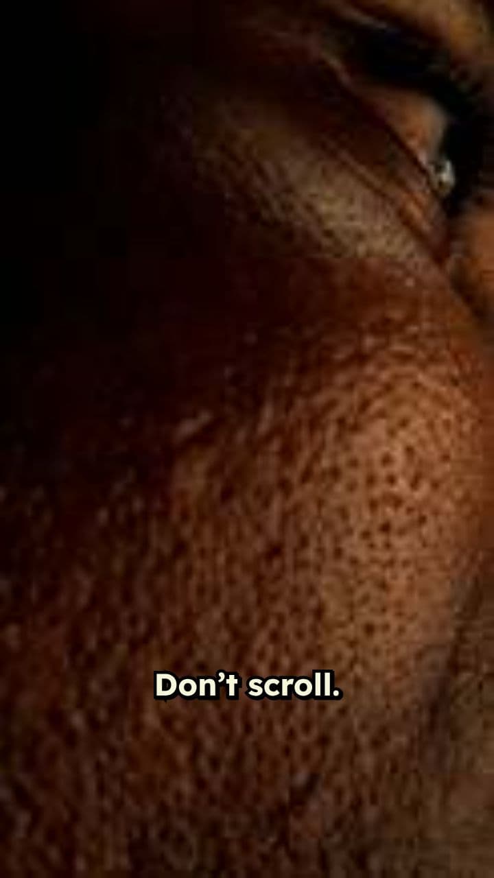 The Impact of Mouth Breathing on Your Face