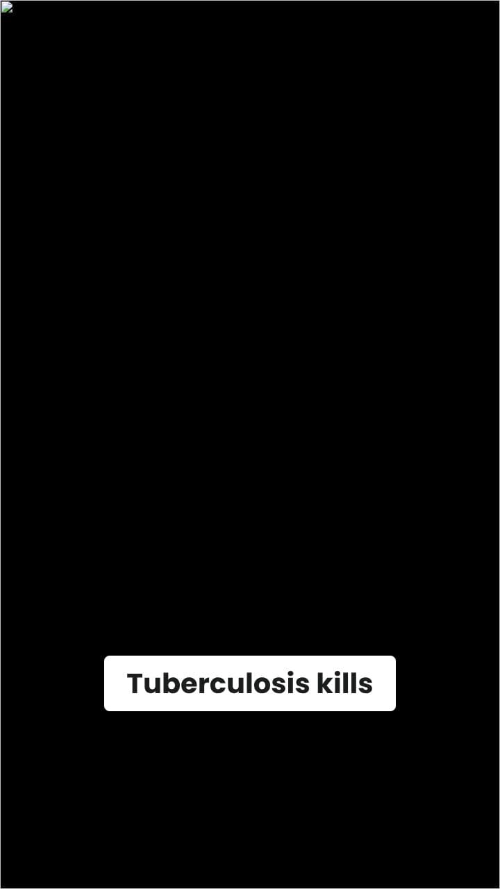 The Silent Threat of Tuberculosis