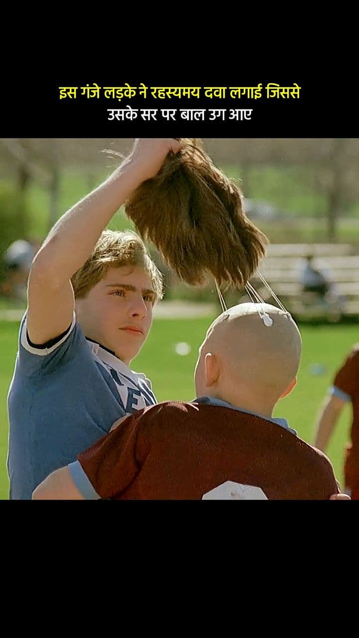 गंजे लड़के के बालों की अनोखी कहानी