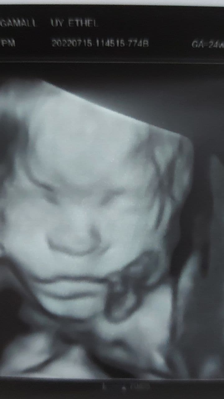 I Wish You Could See