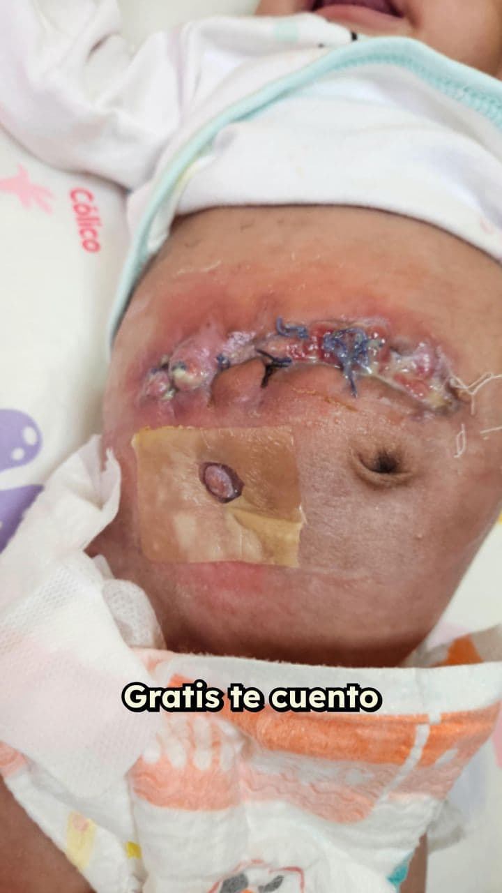 Batallas de valentía en bebés