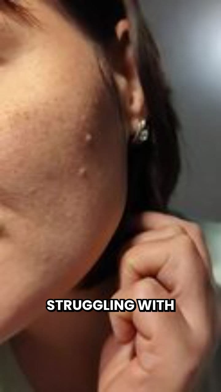 Clear Skin with Blackhead Vacuum Remover