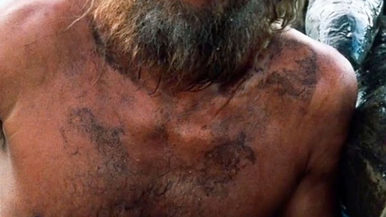 Actors Who Suffered Lasting Injuries on Set