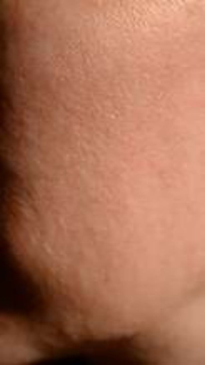 Hyper-Realistic Skincare Treatment: Pore Cleaning