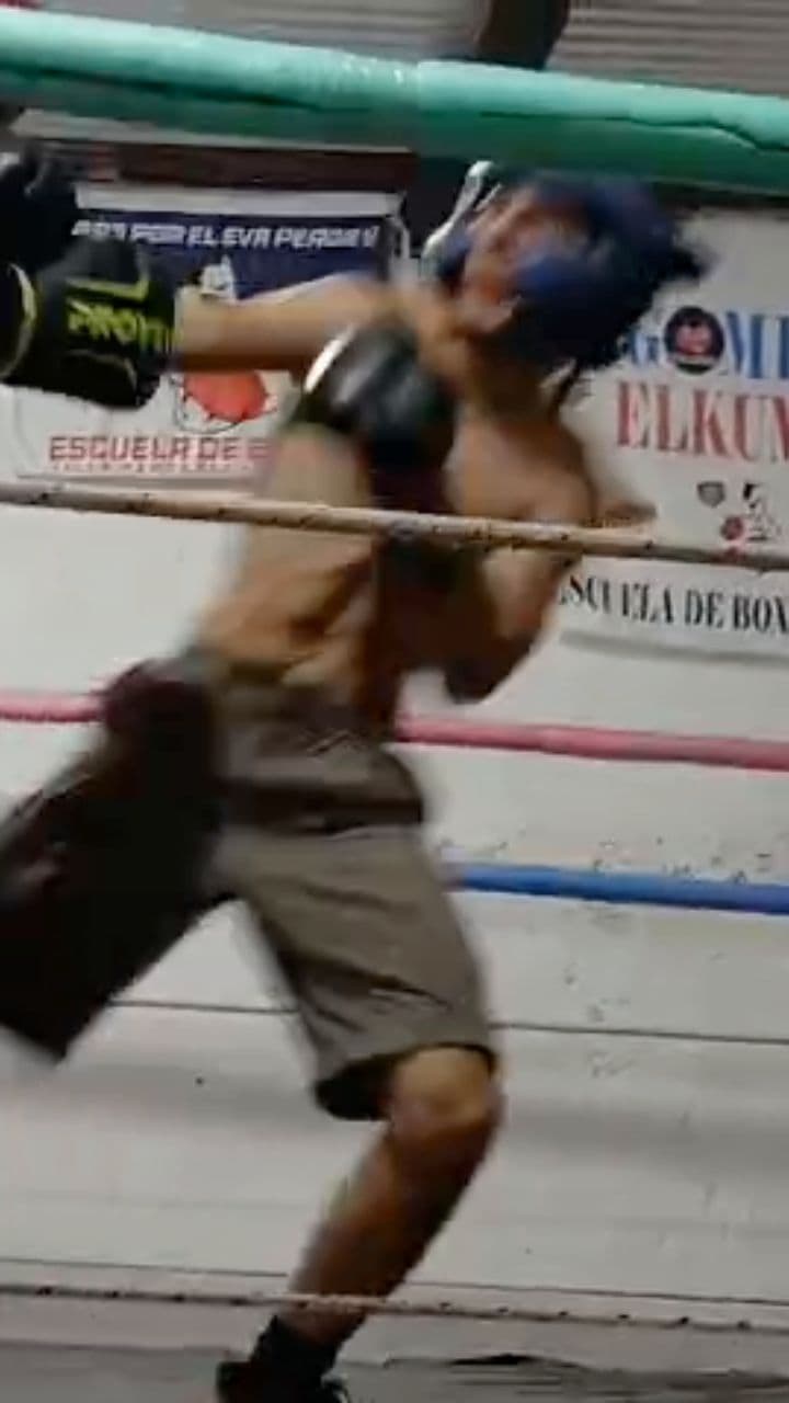 No me grabes, me duele el brazo