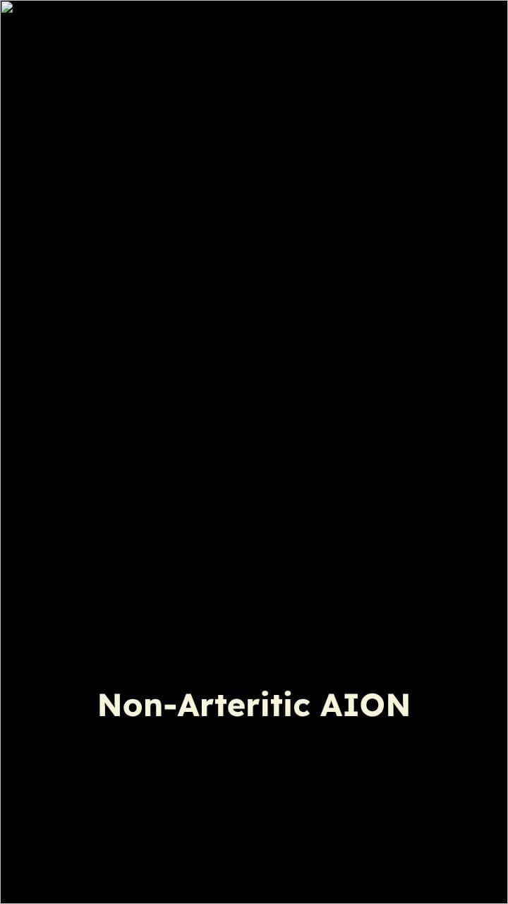 Optic Neuropathies Overview